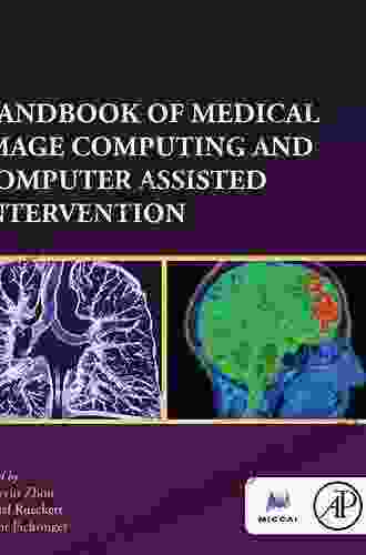 Handbook Of Medical Image Computing And Computer Assisted Intervention (The MICCAI Society Series)